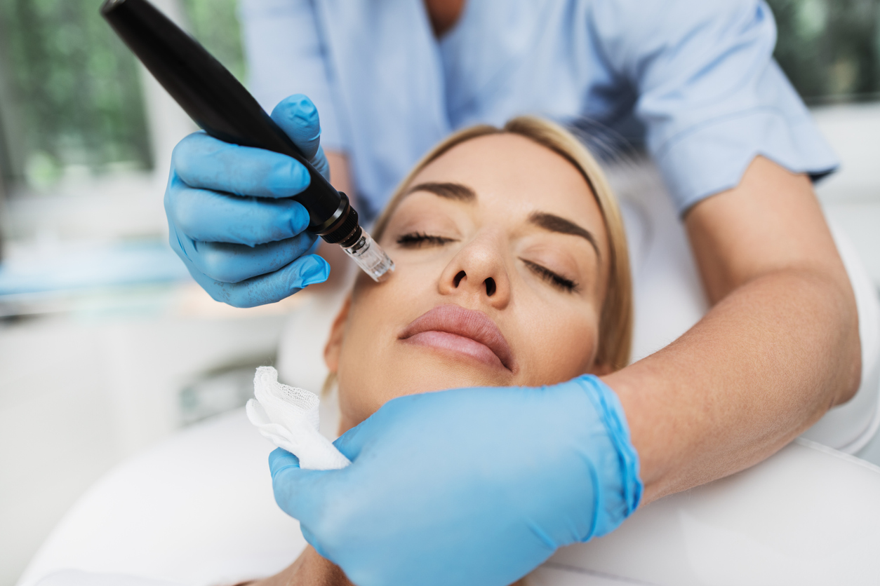 Microneedling feature